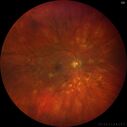 serpiginous2_117484_121223_36.jpg