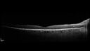 serpiginous_117484_103123_07.jpg