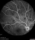 serpiginous_117484_103123_15.jpg
