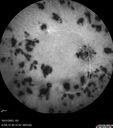 serpiginous_117484_103123_30.jpg