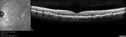 soft-Drusen_cafau_061617_05.jpg