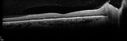 syph_ON_stst1_031116_16.jpg