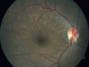 syph_arho_022817_01.png