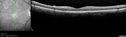 syph_arho_022817_06.jpg