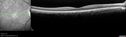 syph_arho_022817_07.jpg
