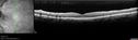 syph_arho_022817_08.jpg