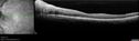syph_arho_022817_09.jpg