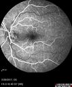 syph_arho_022817_12.jpg