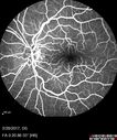syph_arho_022817_13.jpg