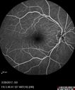 syph_arho_022817_19.jpg