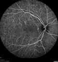 syphilis1_mialc_04122022_25.jpg
