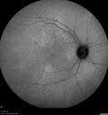 syphilis1_mialc_04122022_27.jpg