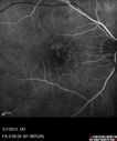 systemic_avastin_102114_13.jpg