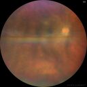 Filename=toxo_alwri1_041522_06.jpg
Filesize=8152KiB
Dimensions=3980x3980
Date added=Oct 01, 2022 toxo_alwri1_041522_06.jpg