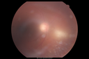 toxo_helo_11071302.png