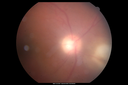 toxo_helo_12041325.png