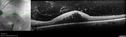 toxo_stmor2_022020_24.jpg