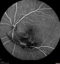 toxo_stmor2_022020_31.jpg