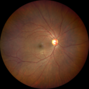 toxo_stxio_080119_0001.png