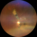 toxo_stxio_090919_0005.png