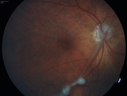toxocara_juma_120914_02.png
