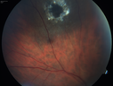 toxocara_juma_120914_04.png