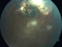 toxoplasmosis2_borod_031919_19.png