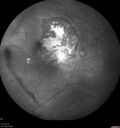 toxoplasmosis2_borod_031919_23.jpg