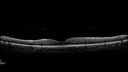 toxoplasmosis2_borod_031919_24.jpg