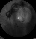 toxoplasmosis2_borod_031919_28.jpg