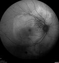 tumor_jetop_042419_10.jpg
