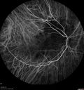 tumor_jetop_042419_30.jpg