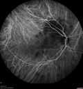 tumor_jetop_042419_32.jpg