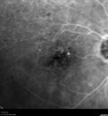 venousMA1-deho_110118_pre_08.jpg
