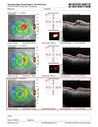 venousMA2-deho_110118_postlaser_12.JPG