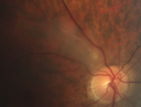 vhl_suad_020218_02.png