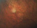 vhl_suad_020218_06.png