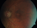 vhl_suad_020218_08.png