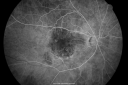 wetamd_63356_281129.png
