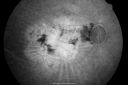 wetamdscarcrfolds_fldo11.png