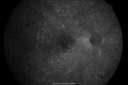 pdr_nve_51677_281829.png