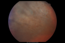 radretpucker_pazo04.png