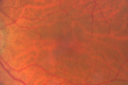 vrtract1movaloss_mm02.png