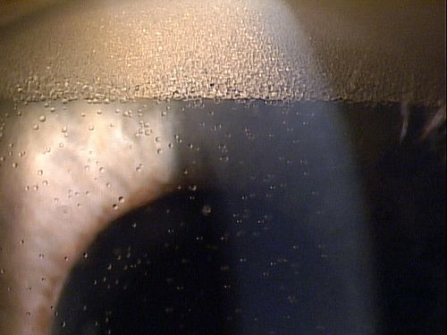 Emulsified silicone oil in anterior chamger
Võtmesõnad: july2012