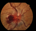 Retina_gallery_5_Nov_20125B0025D.png
