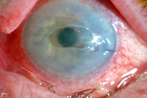 Cornea Ulcer/Abrasion
