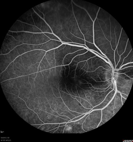 55 degree fa mid. od
similar photo to autofluorescence
