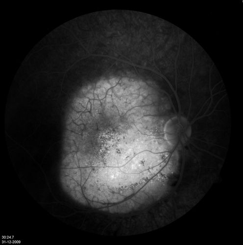 retinagallery_282729.jpg