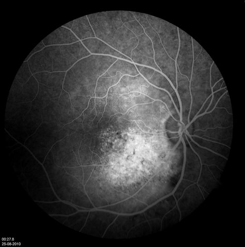 retinagallery_283829.jpg