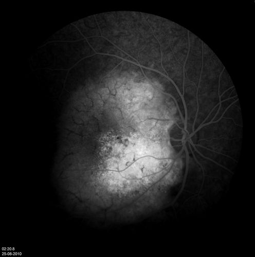 retinagallery_285229.jpg